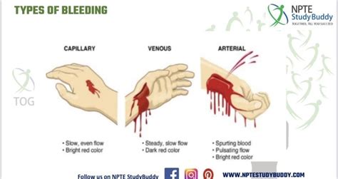 bleed 뜻: 상처에서 피가 나오는 현상과 그 이상의 의미